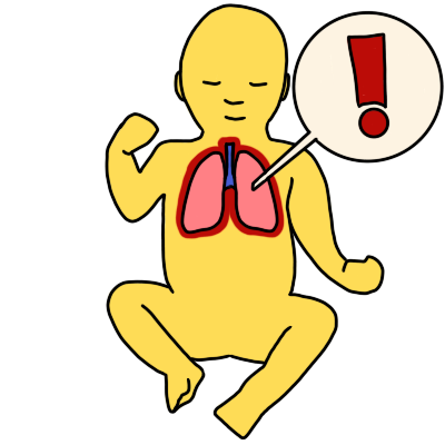 an infant with emoji yellow skin and pink lungs outlined in red. a white circle with a red exclamation mark in it connects to the lungs.